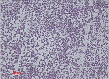 表皮ブドウ球菌_Staphylococcus epidermidis　