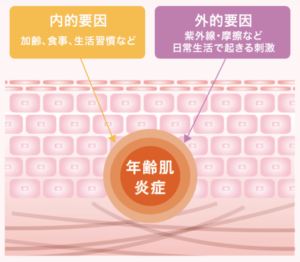 微弱炎症のきっかけ